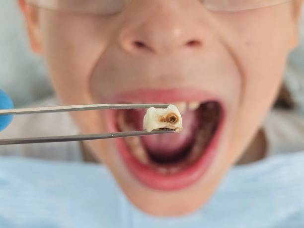 Best Urgent Tooth Repair  in Casas Adobes, AZ
